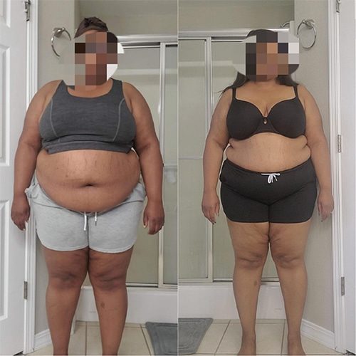 Two striking before and after body transformations of a woman.